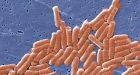 Contamination scare leading to food recalls in Canada