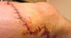 Police dog attack sparks Vancouver lawsuit