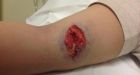 Pitbull attack on pregnant woman has Labrador town worried